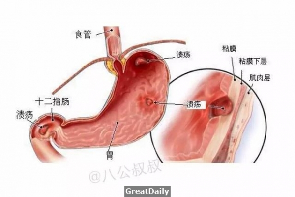 狗狗得了這種病，發病七天內死亡率可能高達25%！